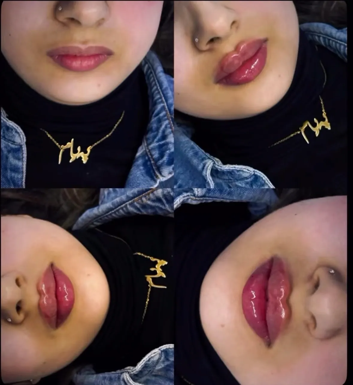 Séance glaçage corps au Silkor Center